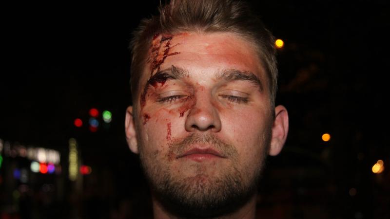 Thaddeus Pall was attacked in May 2017 in downtown Madison, Wis., by a group of men he suspected were anti-fascists. The FBI has investigated the attack, which Pall said came after he and other Proud Boys members met at a Madison bar. 